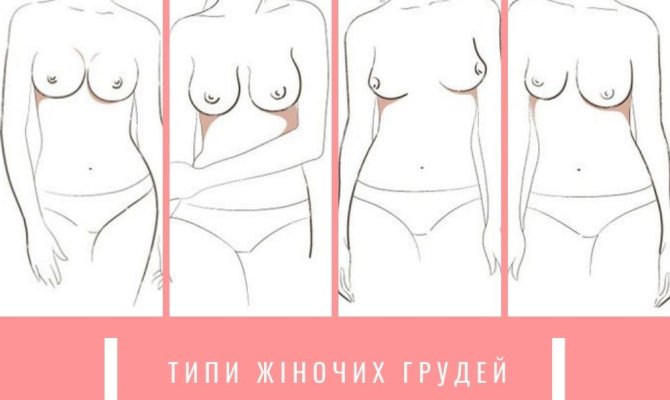 Типы женской груди